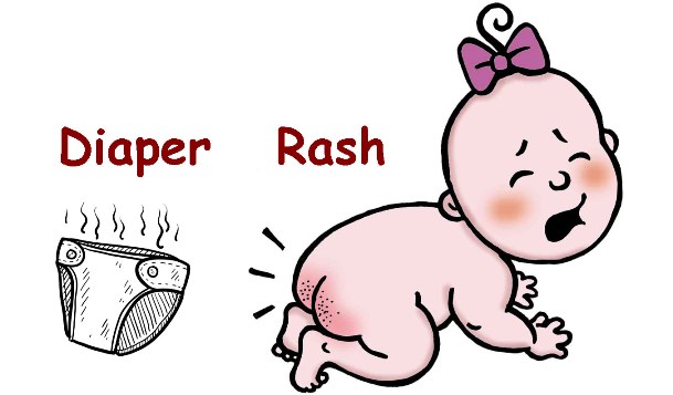 diaper-rash